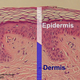 Illustration for article titled The Wrong Drug Reaction Could Literally Make Your Skin Peel Off